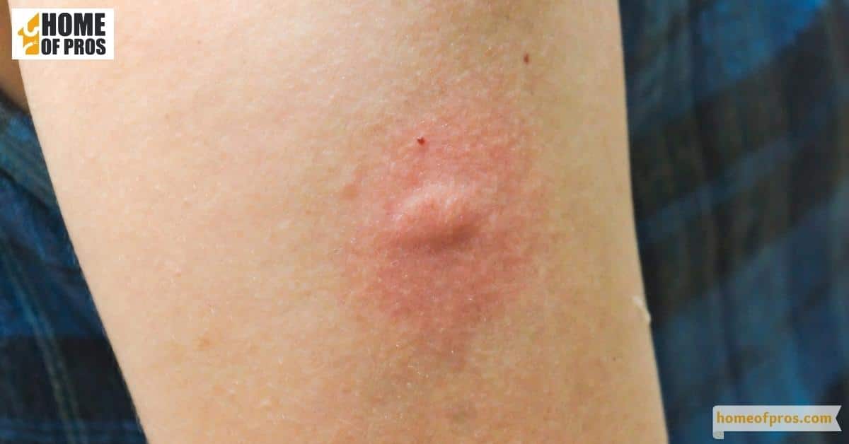 Physical Appearance of the Bite